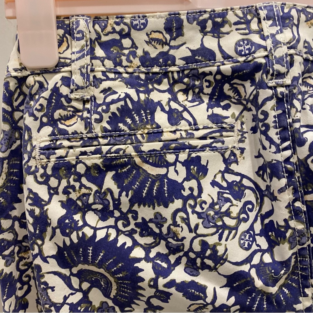 Tory Burch Izzy Printed Crop Skinny Jeans - Picture 6 of 7